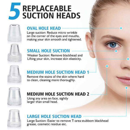 Blackhead Vacuum Remover - FashionAngelz