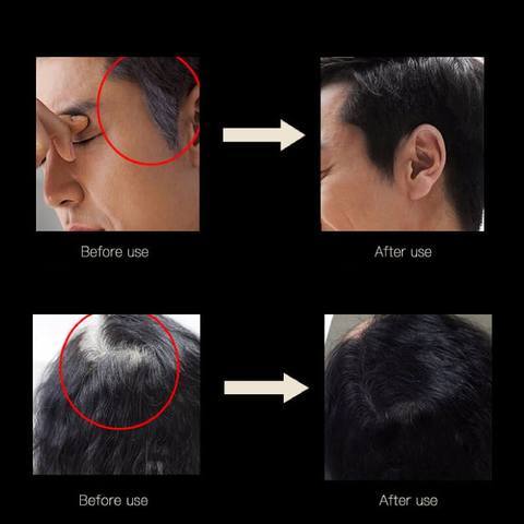 Instant Grey Root Hair Coverage - FashionAngelz